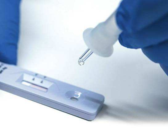 行业新闻 | 国家药监局已批准47个新冠病毒抗原检测试剂